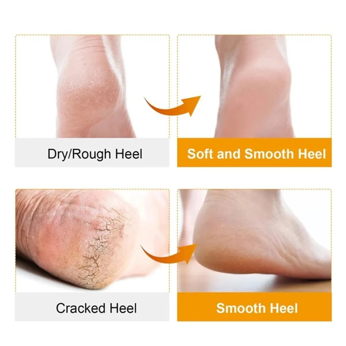 Silicone Gel Moisturizing Socks, Non-slip Socks, Cracked Foot Prevention Socks, Foot Care Tool With Breathable Hole